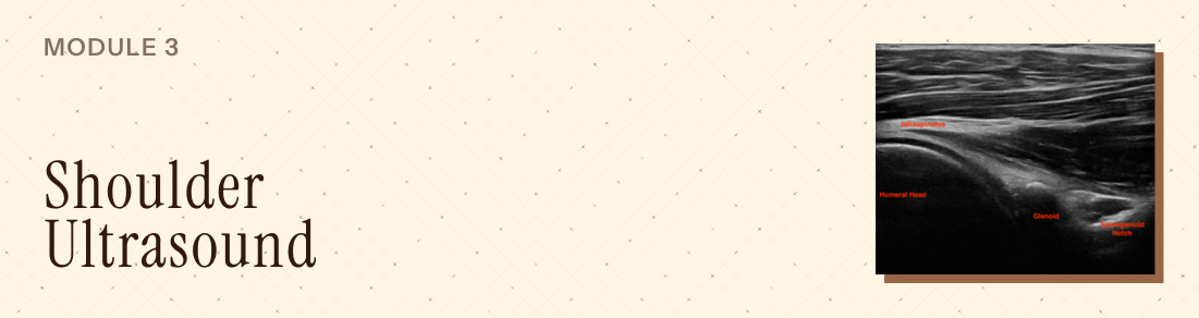 Mod 3 - Shoulder Ultrasound - Advanced MSK Ultrasound Banner