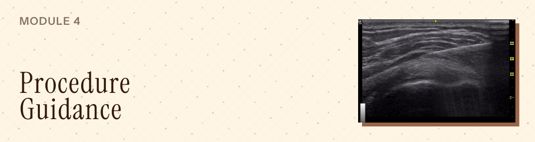 Mod 4 - Procedure Guidance - Advanced MSK Ultrasound Banner